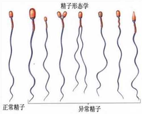 上海做一次代孕需要多少钱_上海